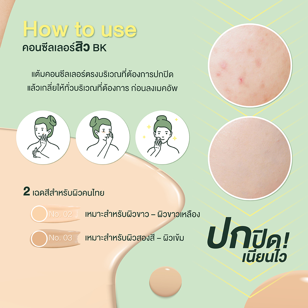 คอนซีลเลอร์ ปกปิด