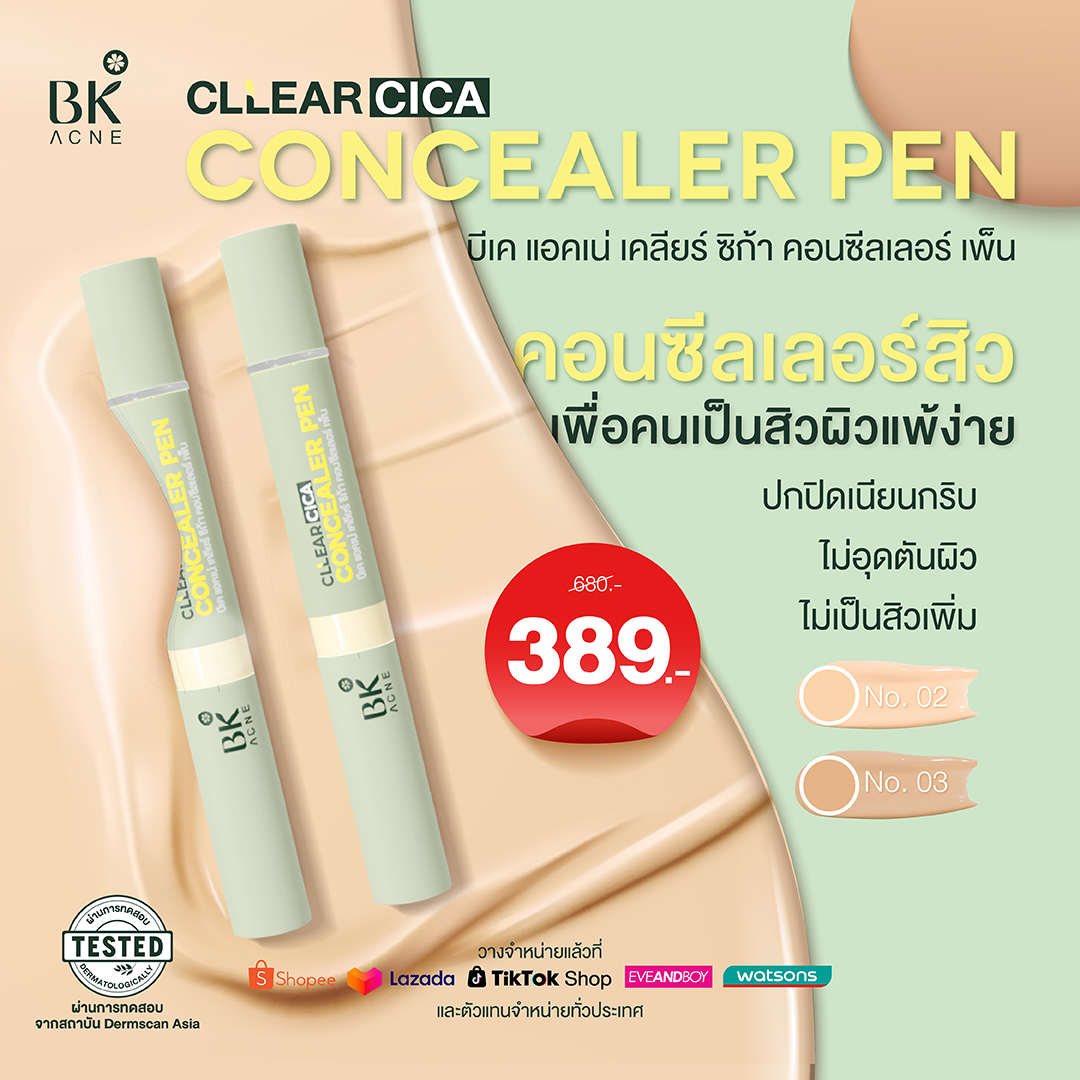 คอนซีลเลอร์ ตัวไหนดี
