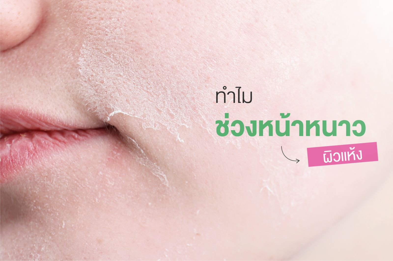 ทำไมหน้าหนาว ผิวแห้ง