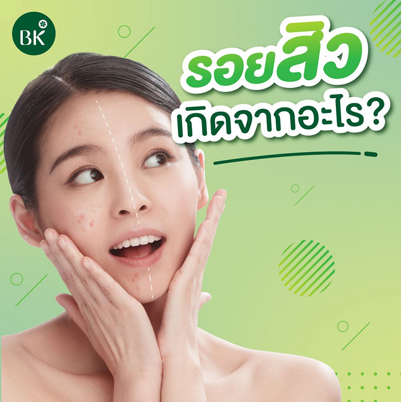 รอยสิว เกิดจากอะไร